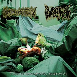 Hydropneumothorax : 2 Acts of Gross Medical Malpractice